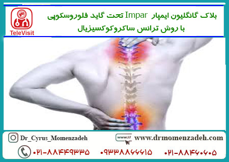 بلاک گانگلیون ایمپار  Impar تحت گاید فلوروسکوپی با روش ترانس ساکروکوکسیژیال Trans-sacrococcygeal