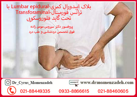 بلاک اپیدورال کمری-Lumbar epidural با ترانس فورمینال-Transforaminal تحت گاید فلوروسکوپی