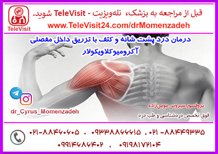     درمان درد پشت شانه و کتف با تزریق داخل مفصلی آکرومیوکلاویکولار   