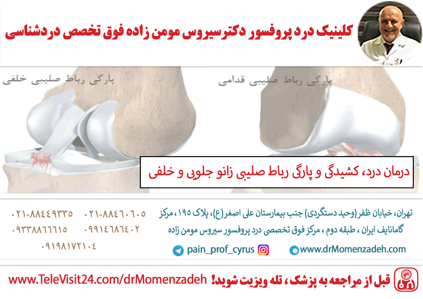 درمان درد، کشیدگی و پارگی رباط صلیبی زانو جلویی و خلفی (ACL,PCL)