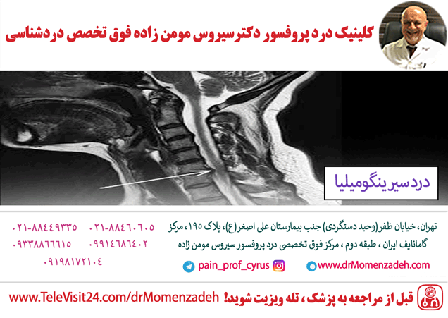 سیرینگومیلیا Syringomyelia