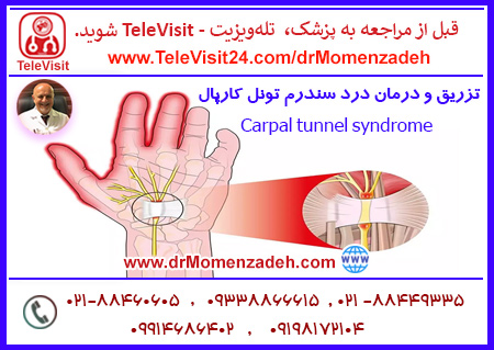 تزریق و درمان درد سندرم تونل کارپال - Carpal tunnel syndrome   