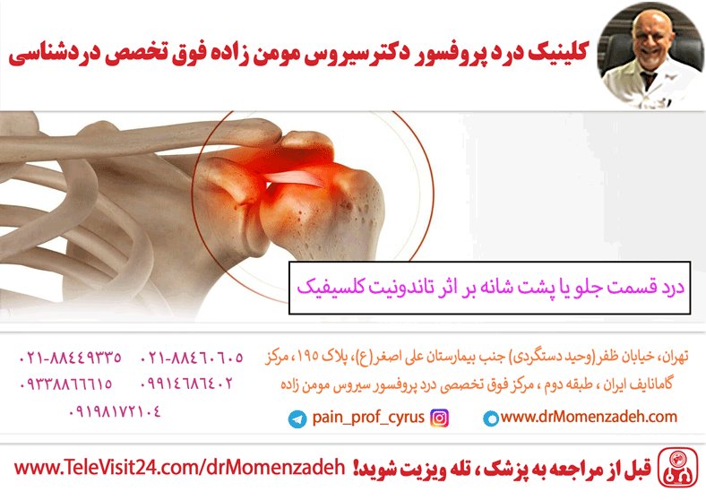 درد قسمت جلو یا پشت شانه بر اثر تاندونیت کلسیفیک