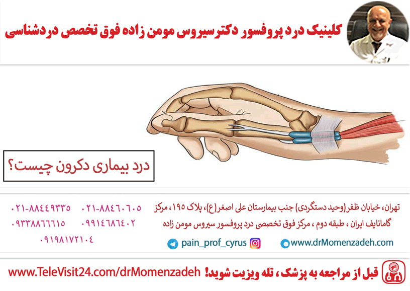 درد بیماری دکرون چیست