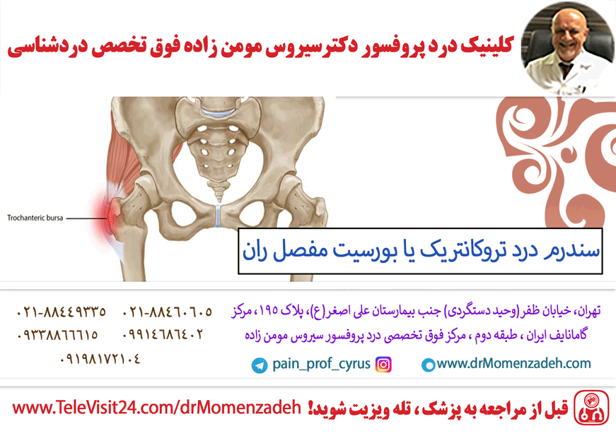 سندرم درد تروکانتریک یا بورسیت مفصل ران