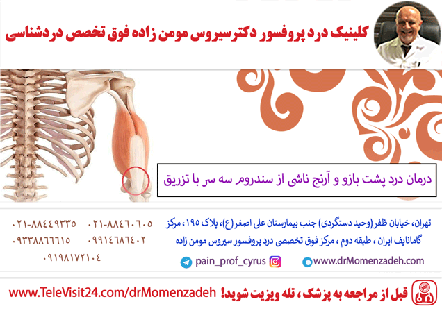 درمان درد پشت بازو و آرنج ناشی از سندروم سه سر با تزریق