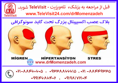 بلاک عصب اکسیپیتال بزرگ - Greater occipital تحت گاید سونوگرافی