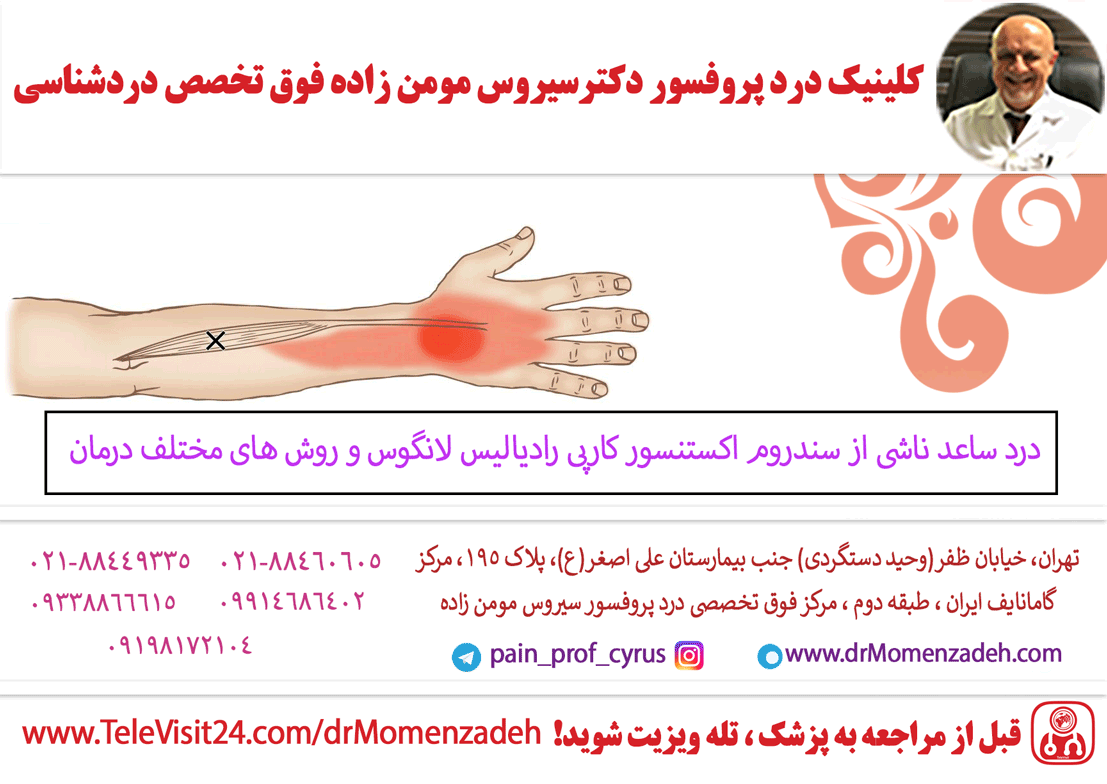 درد ساعد ناشی از سندروم اکستنسور کارپی رادیالیس لانگوس و روش های مختلف درمان