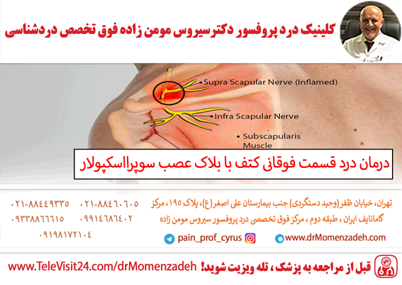 درمان درد قسمت فوقانی متف با بلاک عصب سوپرااسکپولار (Suprascapular)