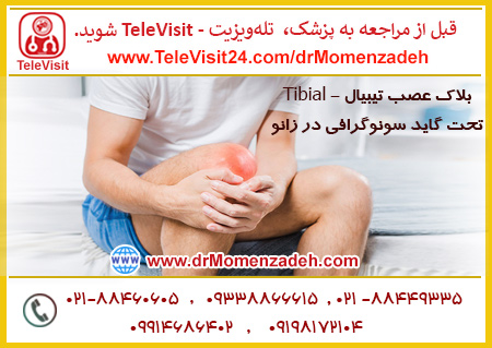 بلاک عصب تیبیال - Tibial تحت گاید سونوگرافی در زانو