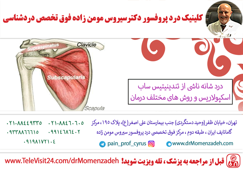 درد شانه ناشی از تندینیتیس ساب اسکپولاریس و روش های مختلف درمان