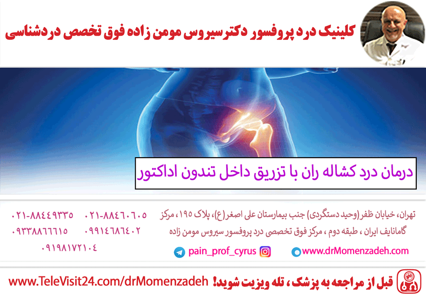 درمان درد کشاله ران با تزریق داخل تندون اداکتور