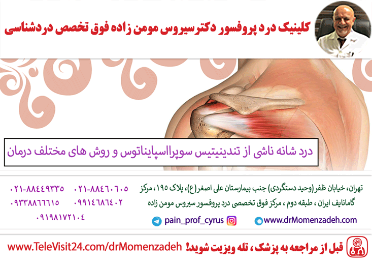 درد شانه ناشی از تندینیتیس سوپرااسپایناتوس و روش های مختلف درمان