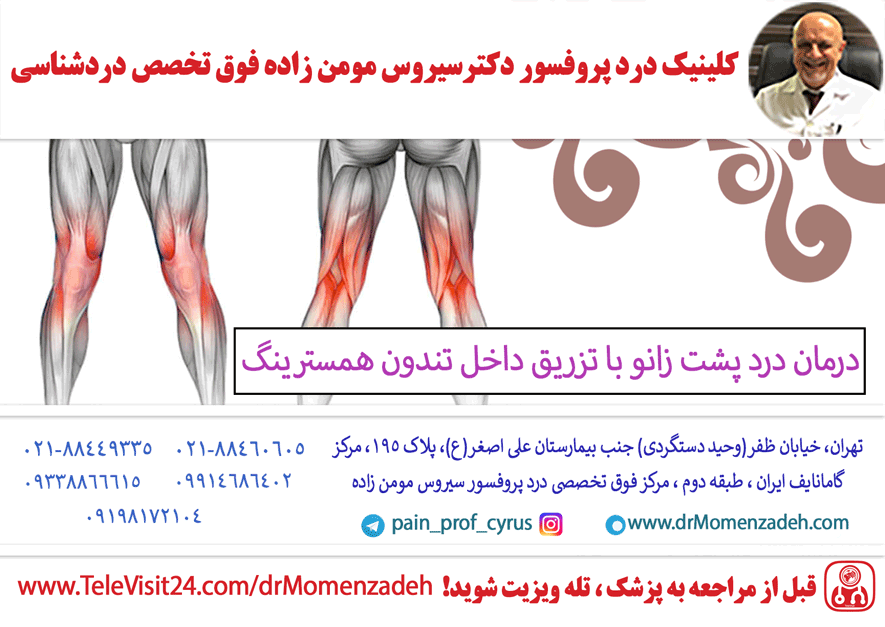 درمان درد پشت زانو با تزریق داخل تندون همسترینگ (Hamestring)