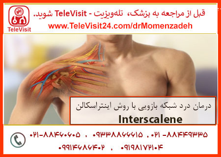 درمان درد شبکه بازویی با روش اینتراسکالن-Interscalene