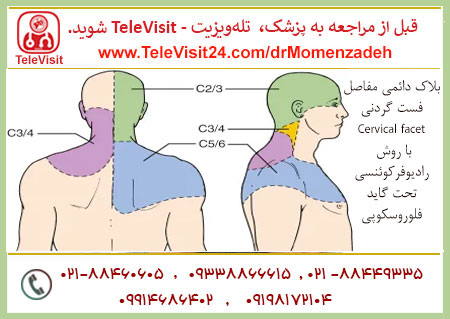 بلاک دائمی مفاصل فست گردنی-Cervical facet با روش رادیوفرکوئنسی تحت گاید فلوروسکوپی