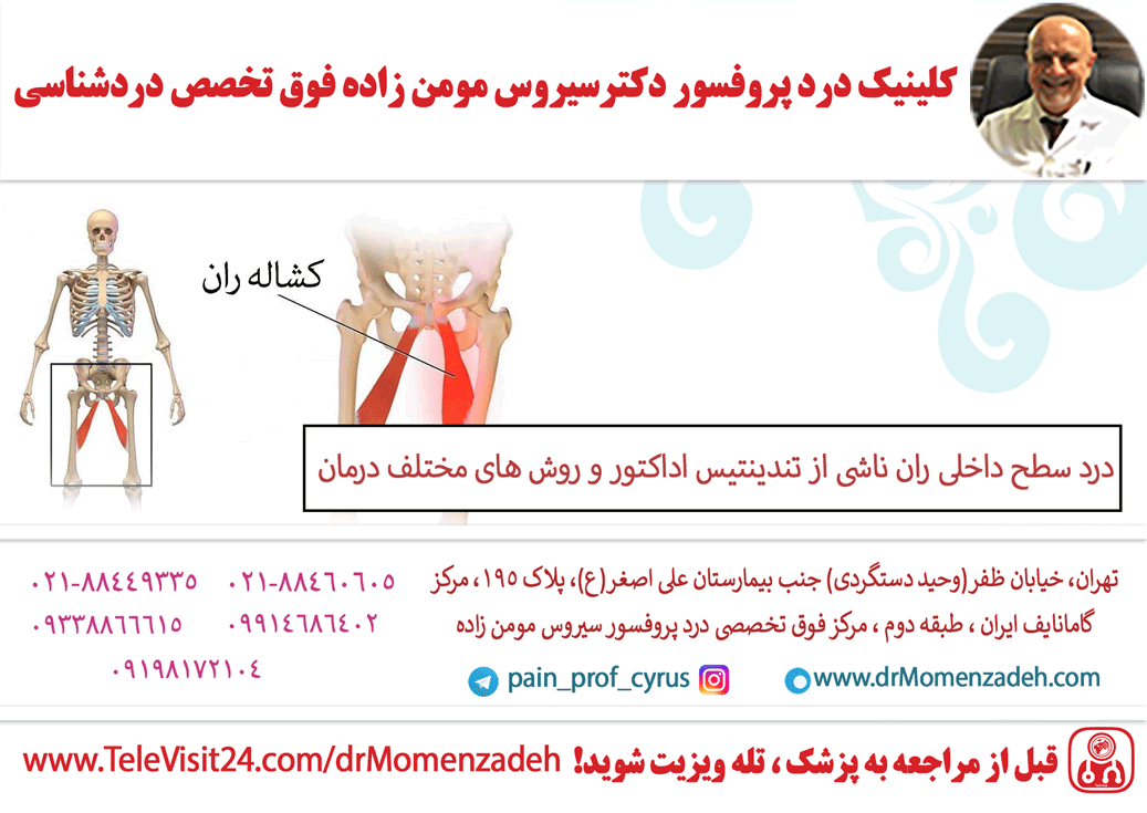 درد سطح داخلی ران ناشی از تندینتیس اداکتور و روش های مختلف درمان