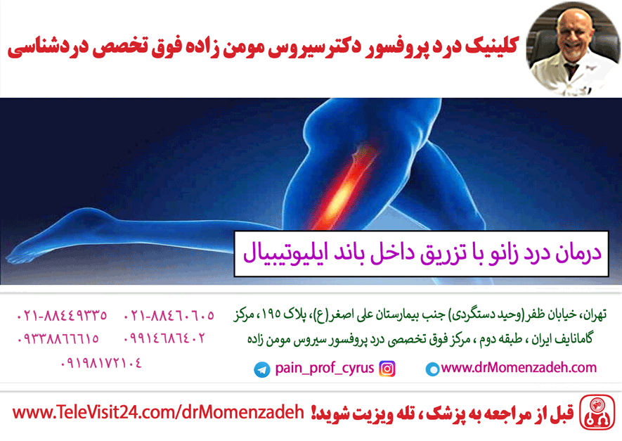 درمان درد زانو با تزریق داخل باند ایلیوتیبیال (Iliotibial band)