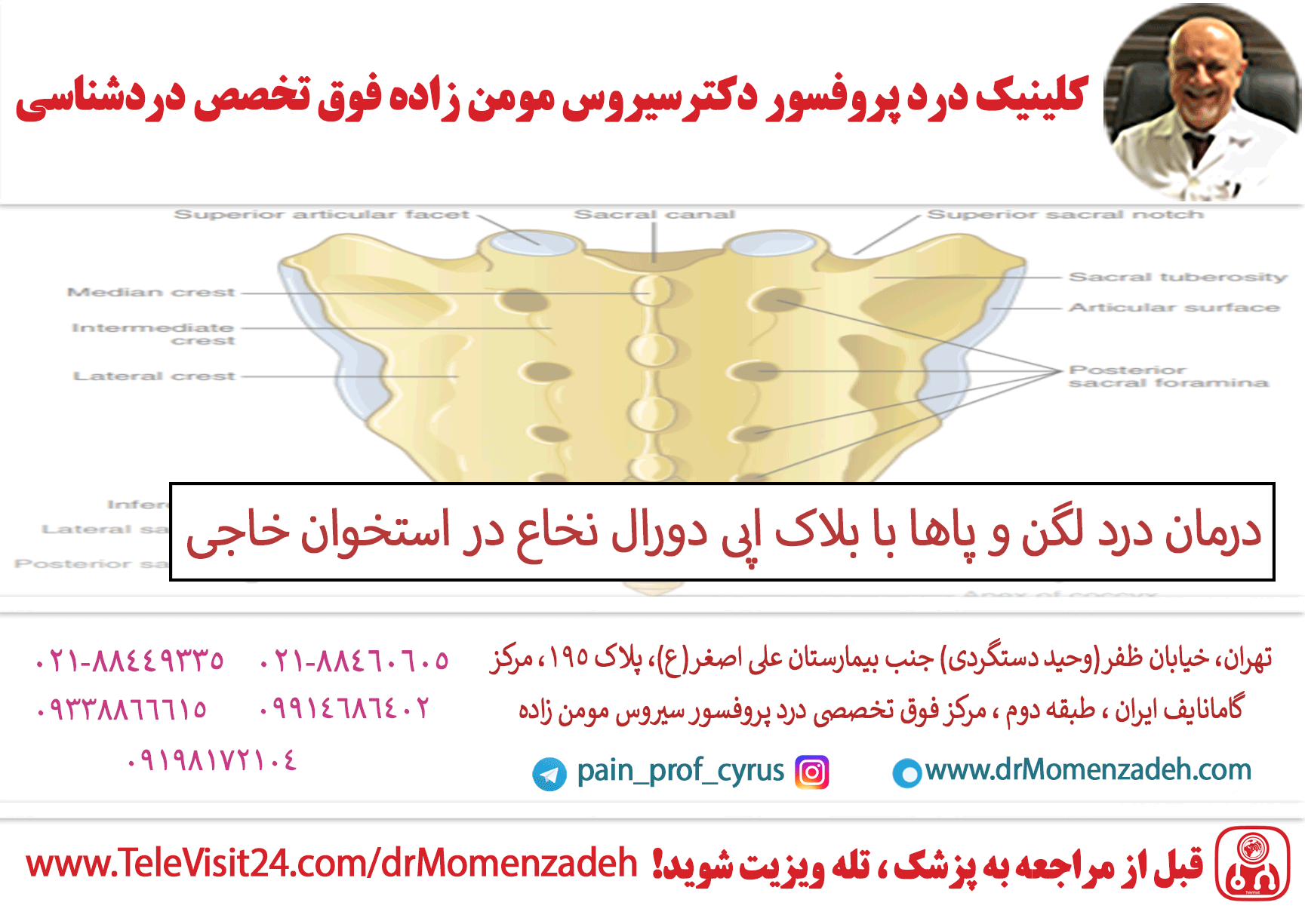 درمان درد لگن و پاها با بلاک اپی دورال (Epidural) نخاع در استخوان خاجی