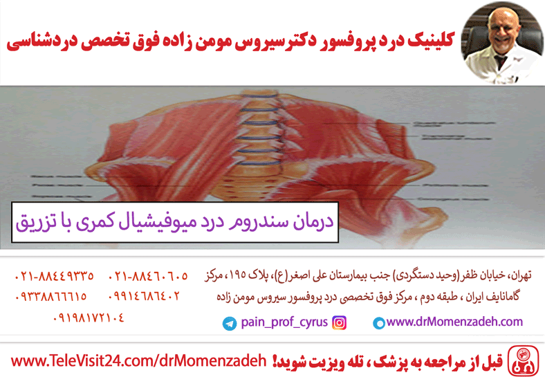 درمان سندروم درد میوفیشیال کمری (Lumbar myofascial syndome) با تزریق