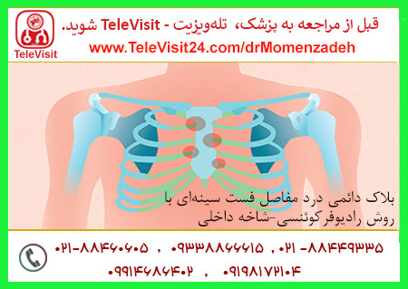 بلاک دائمی درد مفاصل فست سینه‌ای با روش رادیوفرکوئنسی-شاخه داخلی