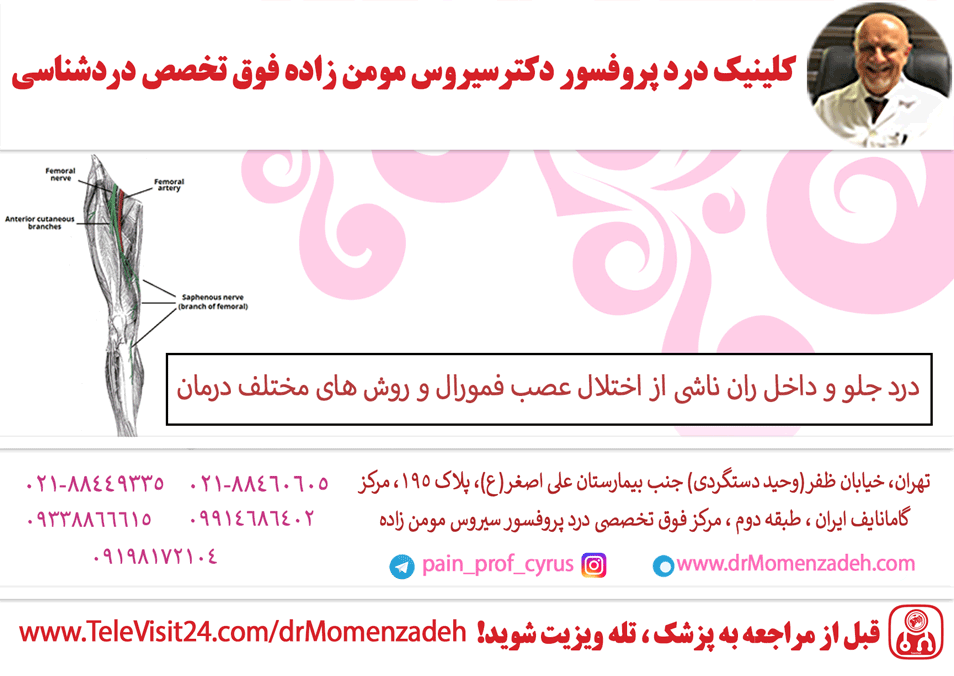 درد جلو و داخل ران ناشی از اختلال عصب فمورال و روش های مختلف درمان