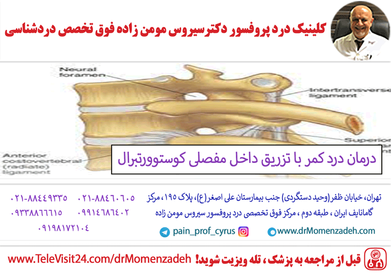 درمان درد کمر با تزریق داخل مفصلی کوستوورتبرال (Costovertebral)