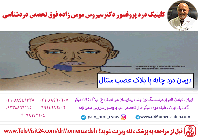 درمان درد چانه با بلاک عصب منتال (Mental)