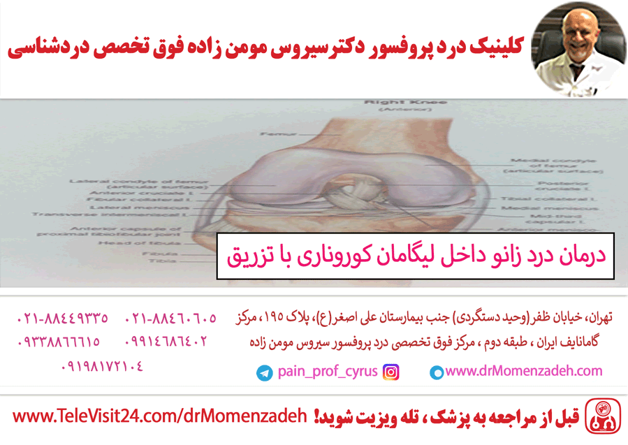 درمان درد زانو داخل لیگامان کوروناری (Coronary Ligament) با تزریق