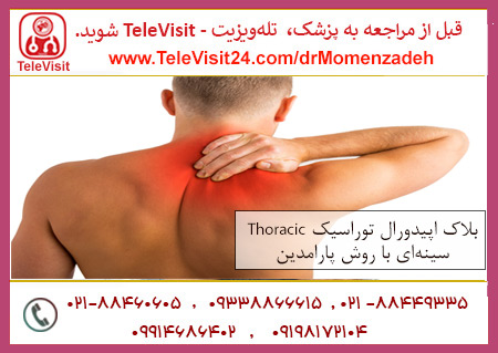 بلاک اپیدورال توراسیک - Thoracic سینه‌ای با روش پارامدین Paramedian