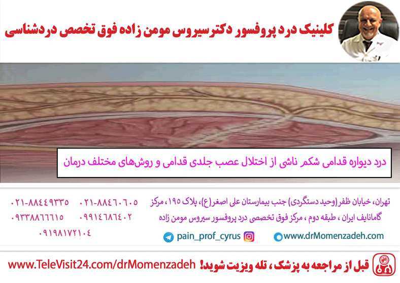 درد دیواره قدامی شکم ناشی از اختلال عصب جلدی قدامی و روش های مختلف درمان