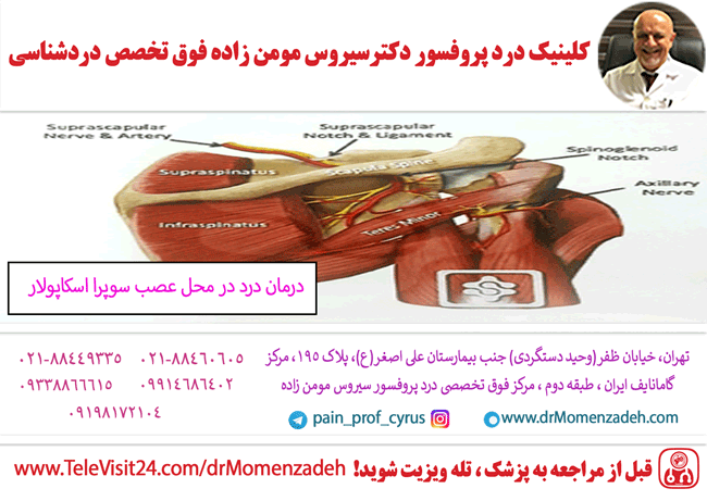 درمان درد در محل عصب سوپرا اسکاپولار(تشخیص و درمان درد)