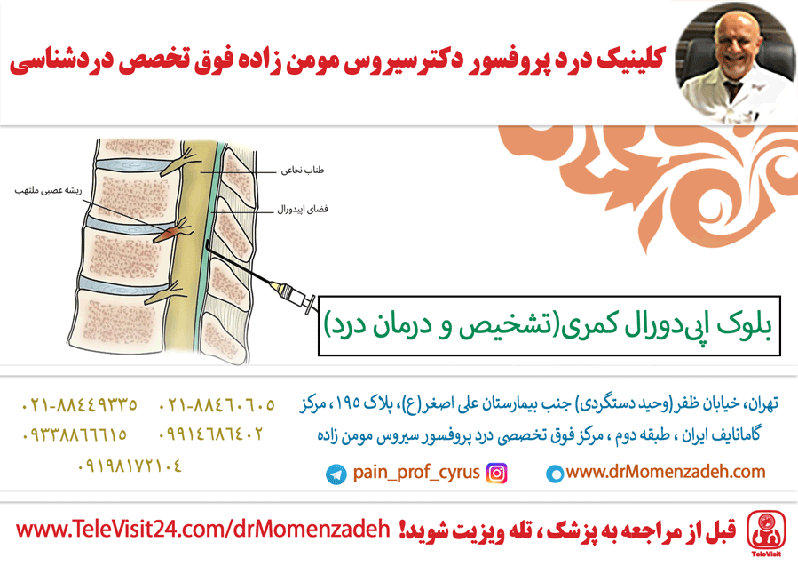 بلوک اپی‌دورال کمری(تشخیص و درمان درد)