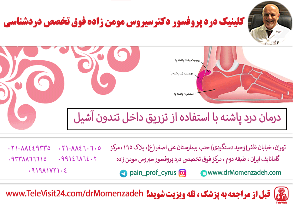 درمان درد پاشنه با استفاده از تزریق داخل تندون آشیل