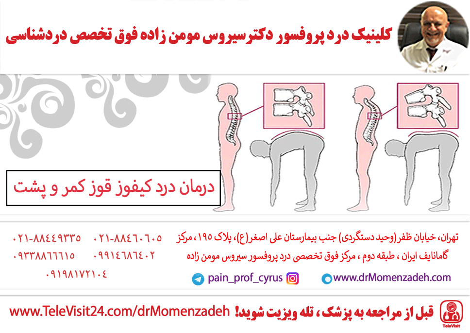 درمان درد کیفوز قوز کمر و پشت