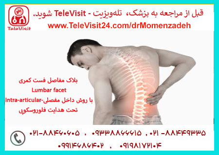 بلاک مفاصل فست کمری-Lumbar facet با روش داخل مفصلی-Intra-articular تحت هدایت فلوروسکوپی