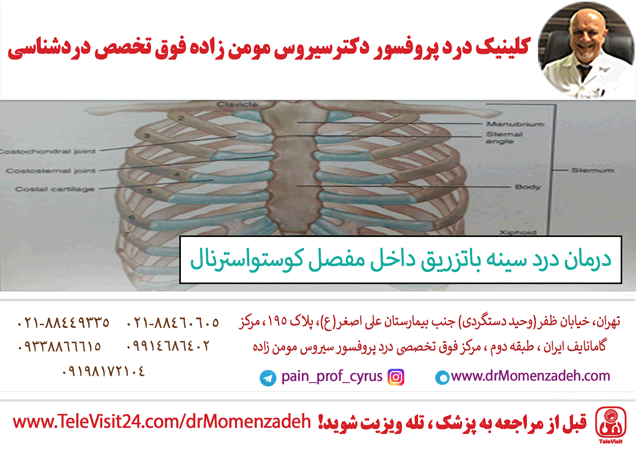 درمان درد سینه باتزریق داخل مفصل کوستواسترنال