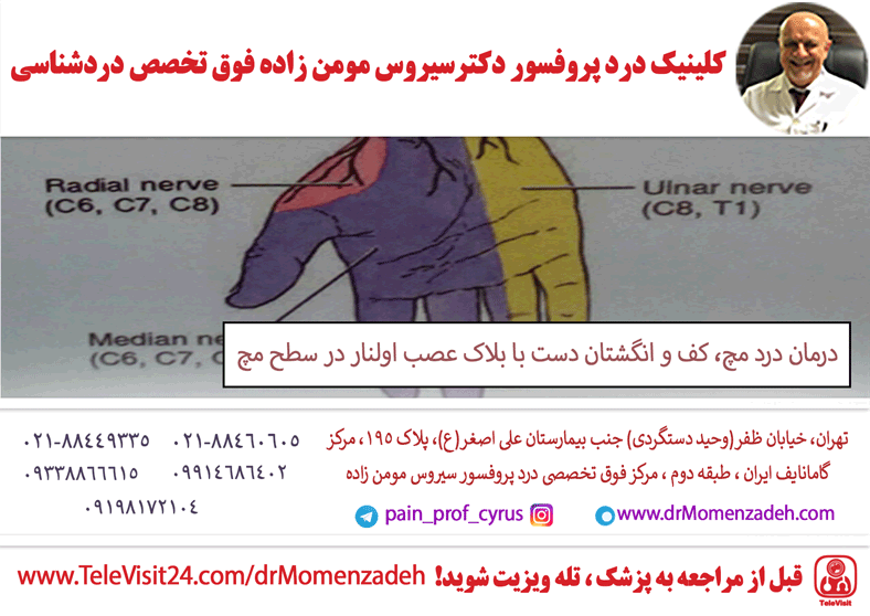 درمان درد مچ، کف و انگشتان دست با بلاک عصب اولنار (Ulnar) در سطح مچ