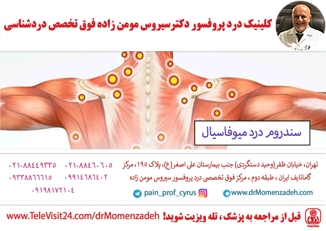 سندروم درد میوفاسیال