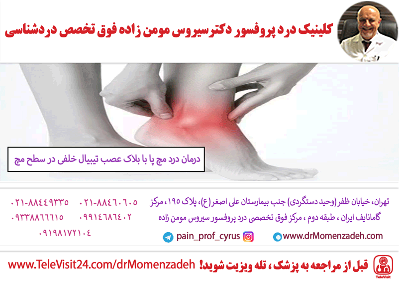 درمان درد مچ پا با بلاک عصب تیبیال خلفی (Posterior Tibial) در سطح مچ