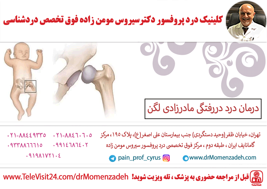 درمان درد دررفتگی مادرزادی لگن 