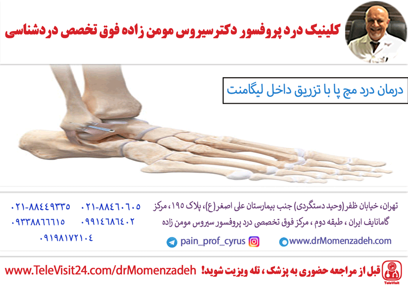 درمان درد مچ پا با تزریق داخل لیگامنت فیبولوکالکانیال