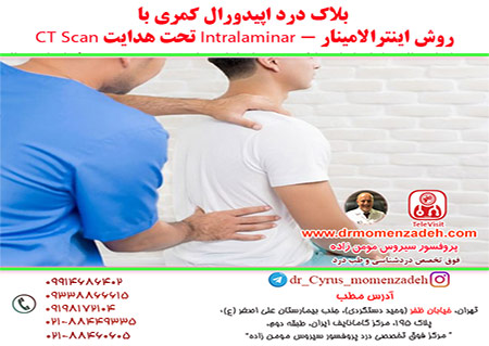 بلاک درد اپیدورال کمری با روش اینترالامینار - Intralaminar تحت هدایت CT Scan