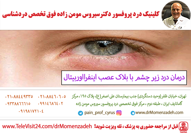 درمان درد زیر چشم با بلاک عصب اینفرااوربیتال (Infraorbital)