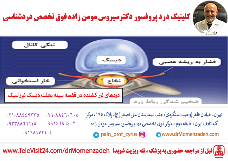 دردهای تیر کشنده در قفسه سینه بعلت دیسک توراسیک