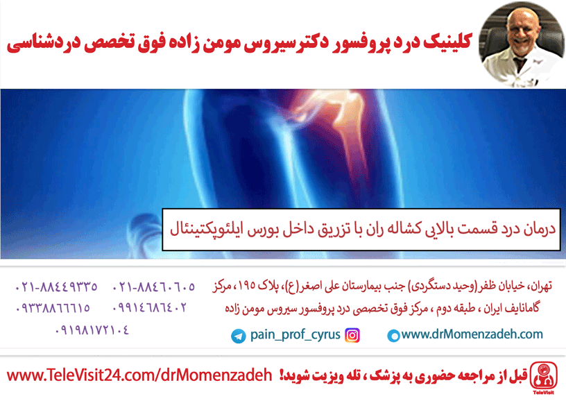 درمان درد قسمت بالایی کشاله ران با تزریق داخل بورس ایلئوپکتینئال (Ilieopectineal)