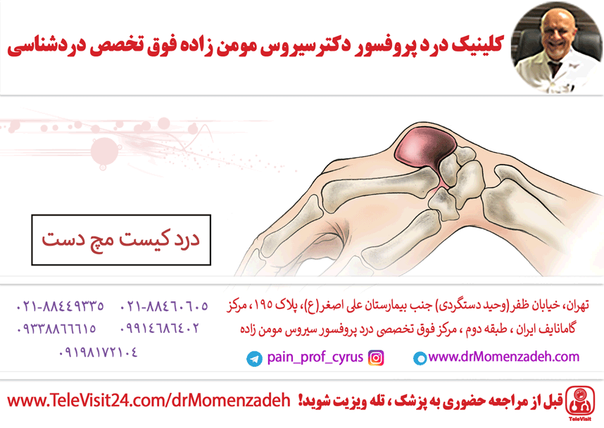 درد کیست مچ دست