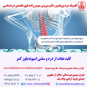 کلید نجات از درد و سفتی اسپوندیلوز کمر