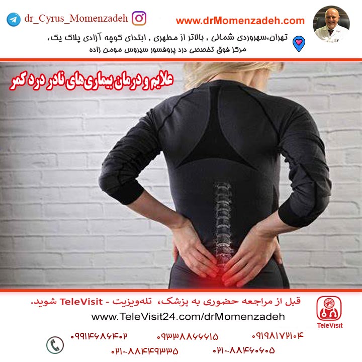 علایم و درمان بیماری‌های نادر درد کمر