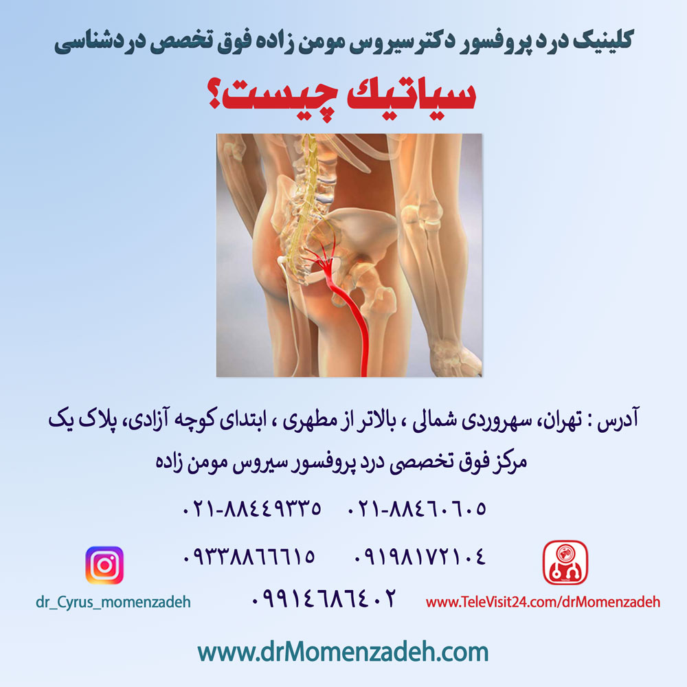 درمان درد سیاتیک چیست؟